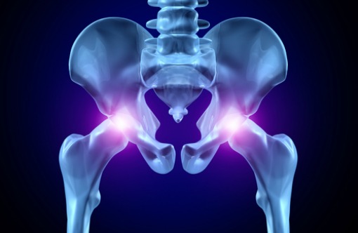 Joint Implants
